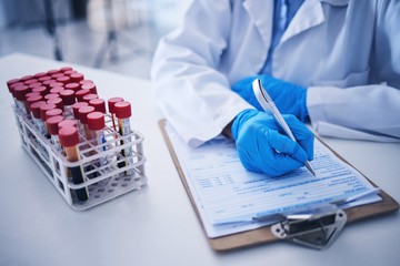 Hogyan mutatható ki a daganat vérből és vizeletből?