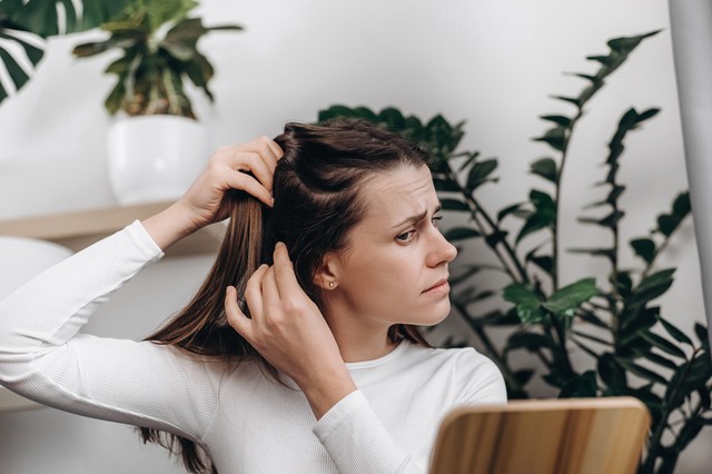 41 évesnő vagyok, felül elvékonyodott a hajam, mit tehetek? Az orvos válaszol