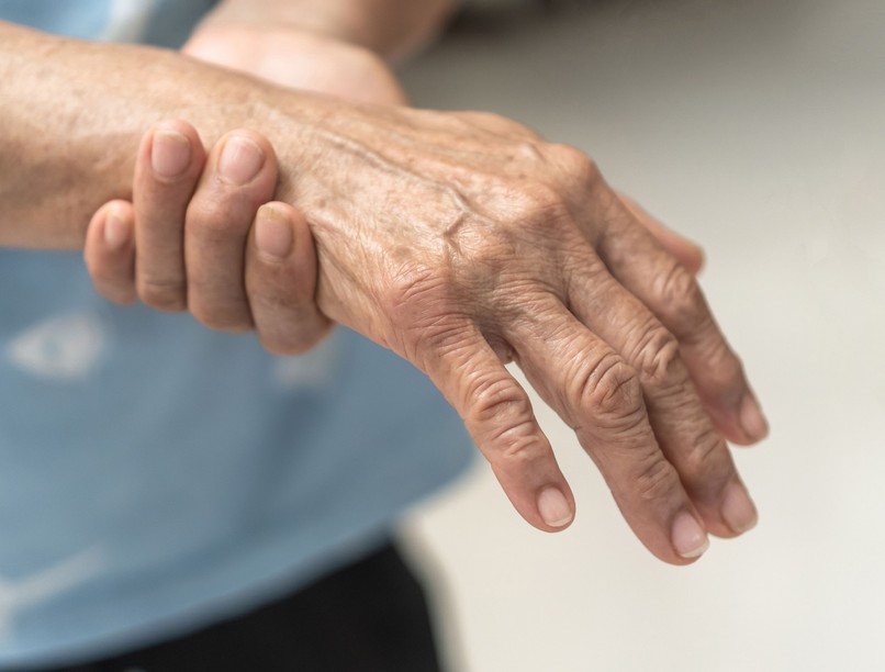 Reggeli kézmerevség duzzanat ízületi gyulladás tünetei artritisz