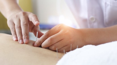 Mire jó az akupunktúra? című cikk nyitóképe