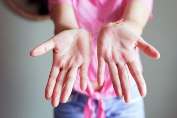Nézze meg a tenyerét! Ha ilyen jelet lát rajta, előrehaladott zsírmájra utalhat  