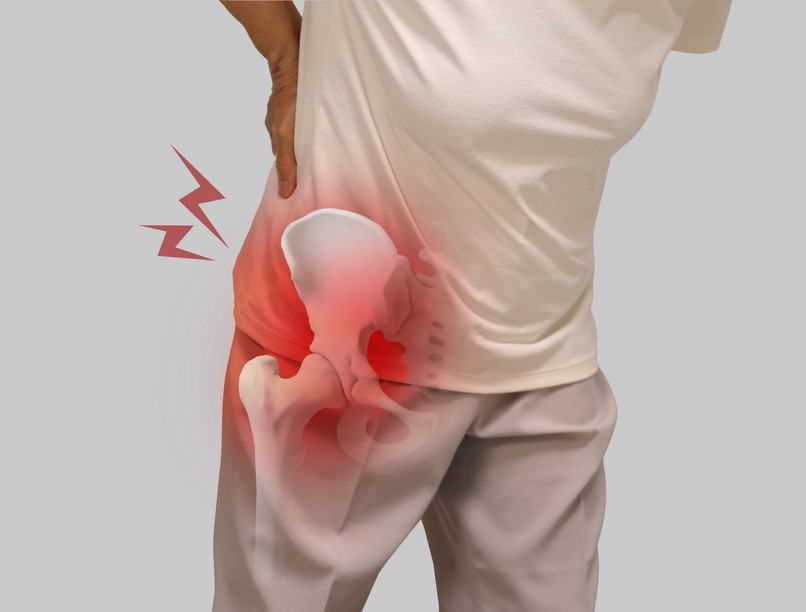 hírek ortopéd csípőműtét túlsúly