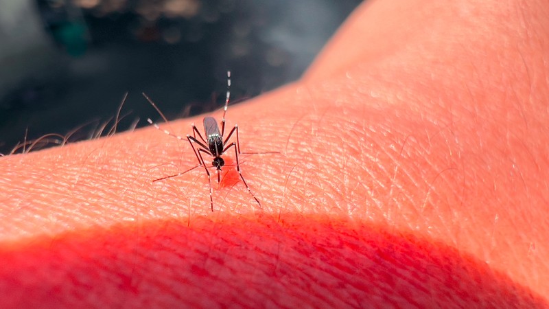 Sárgaláz: tünetei, vizsgálata és kezelési lehetőségei