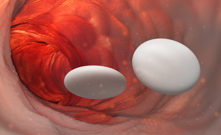 A sok gyomorsavra a leggyakrabban a gyomorégés, a gyomorsav nyelőcsőbe való visszacsorgása figyelmeztethet. Mit tehetünk ellene?