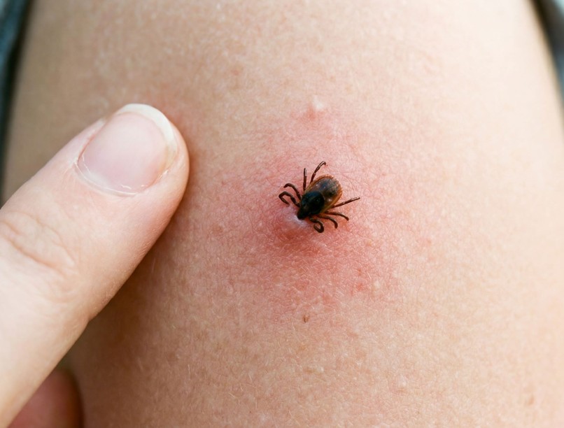 lyme-kór kullancs mennyi idő fertőz