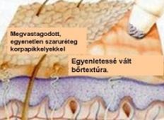 Kulcs a kortalan szépséghez?