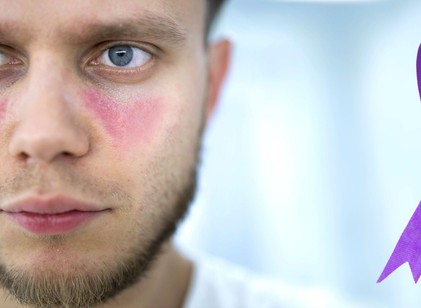 A lupus első jelei: ezeket a tüneteket sokan hónapokig figyelmen kívül hagyják című cikk nyitóképe