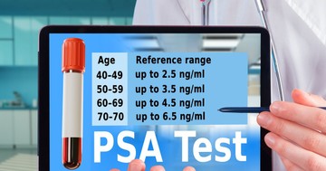 Mi a normális PSA-szint életkor szerint? Ezt jelzik a csillagos eltérések a leleten