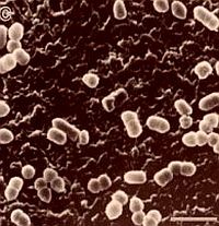 Meglepő felismerés: bélbaktériumok és a reumatoid artritisz