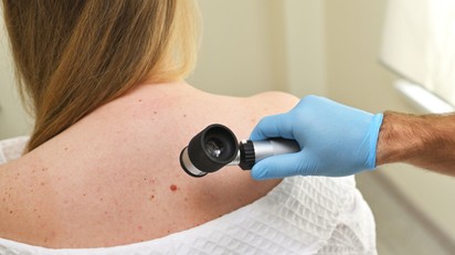 Áttörés a melanoma kezelésében: ígéretes a személyre szabott mRNS-terápia című cikk nyitóképe