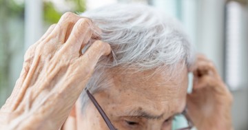  Sárgás, hámló lerakódás a fejbőrön - ez állhat a háttérben 