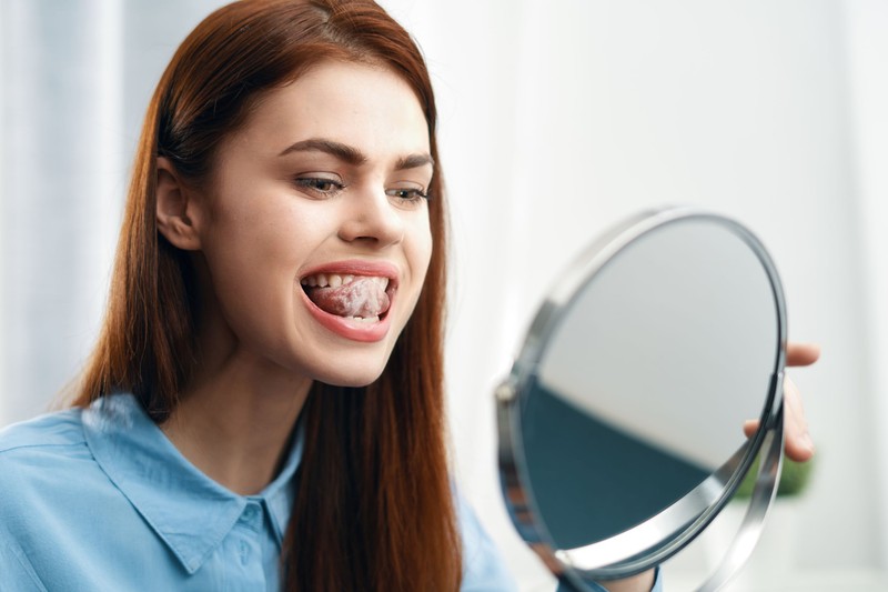 Vörös és fehér foltok vannak a nyelvén? HPV fertőzés is állhat a háttérben!