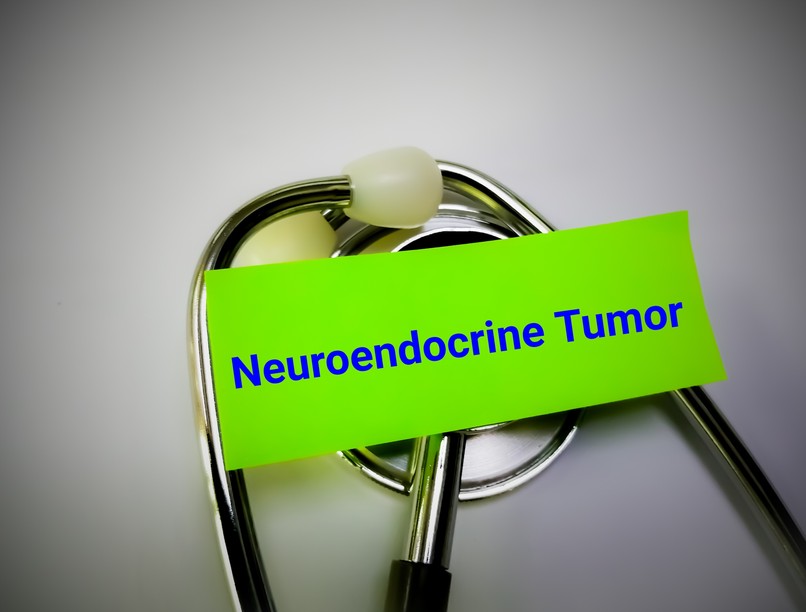 Neuroendokrin daganatok