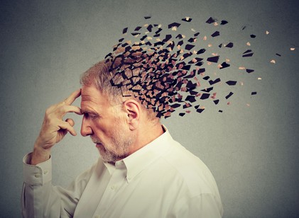 Az Alzheimer-kór korai jelei, amelyeket sokan figyelmen kívül hagynak – neurológusok figyelmeztetnek című cikk nyitóképe