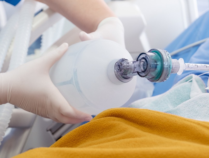 koronavírus, kórház, covid, lélegeztetőgép