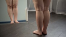 Diéta? Mozgás? Hiába küzd, ha ettől a rejtélyes betegségtől duzzadnak a lábai! című cikk nyitóképe