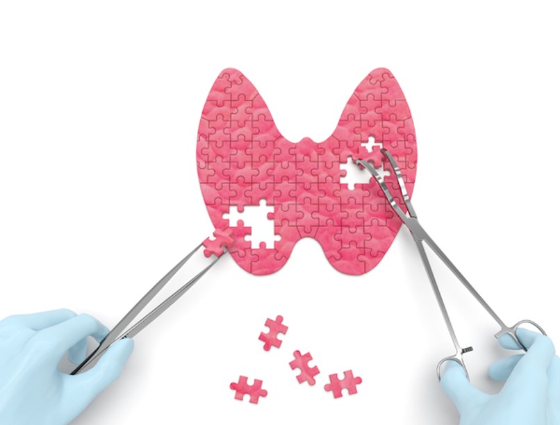 shutterstock_342277517_0