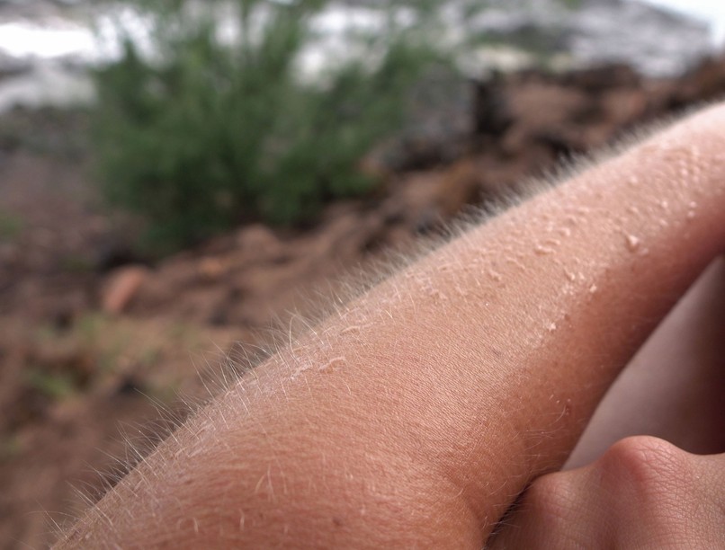 színes miért leszünk libabőrösek oka