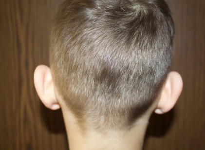 A kisfiamat csúfolják az elálló fülei miatt, van valami eszköz, ami segíthetne? Az orvos válaszol című cikk nyitóképe