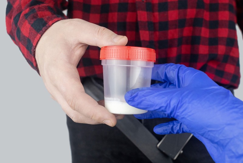 Gyakoribb ejakuláció, jobb spermakép? Ezt mondják erről friss kutatások