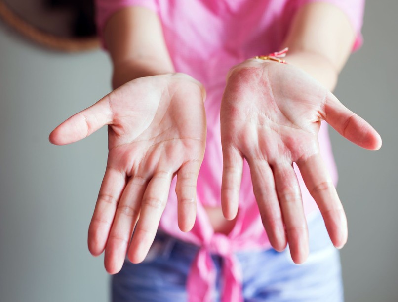 kimerültség, hasfájás, nem-alkoholos zsírmáj, tünetei, kezelése, cukorbetegség, májzsugorodás
