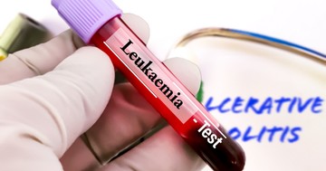  Mi a különbség az akut és a krónikus limfocitás leukémia között? 