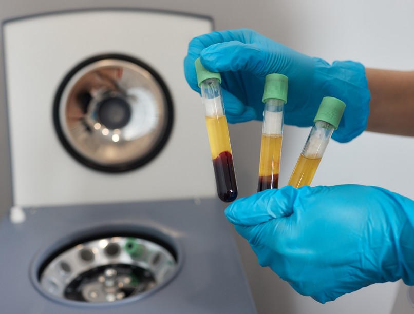 Mi a trombociták száma PLT