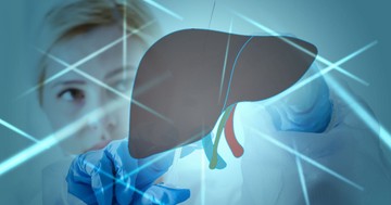  Ultrahanggal kideríthető-e a magas májenzimek oka - mikor igen, mikor nem? 