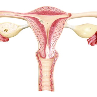Kiderült, mi okozza pontosan a PCOS-t - Így lehet kezelni című cikk nyitóképe