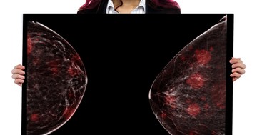  Csomó a mellben: ciszta, lipóma vagy emlőrák okozza? Így derítheti ki 