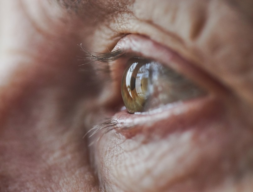 szem, szembetegség, látás, kontaktlencse