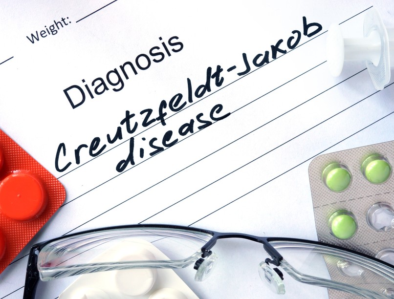 Creutzfeld-Jacob kór diagnózis