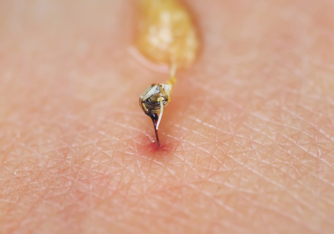 Méhcsípés és dióallergia: létezik olyan teszt, ami kimutatja? Az orvos válaszol című cikk nyitóképe