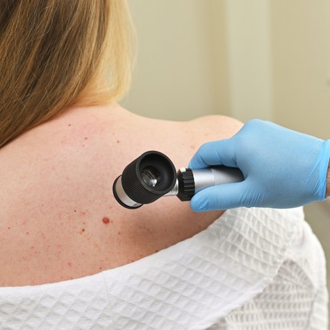Áttörés a melanoma kezelésében: ígéretes a személyre szabott mRNS-terápia című cikk nyitóképe