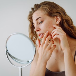 A „halál háromszöge” az arcon: miért figyelmeztetnek rá a bőrgyógyászok? című cikk nyitóképe