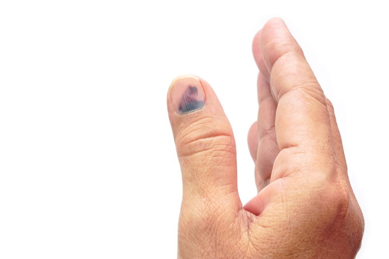 Csak szépséghiba, vagy komoly baj? Ezt árulhatják el a körmei az egészségéről