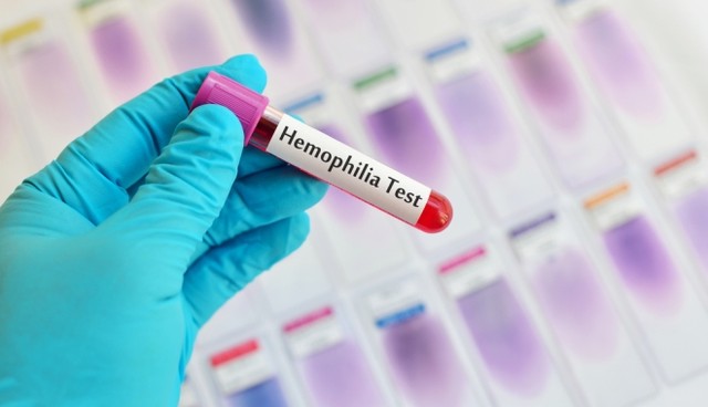 A von Willebrand szindróma a lányokat is érinti