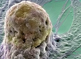 Rákterápiák - és rákőssejtek kialakulása?