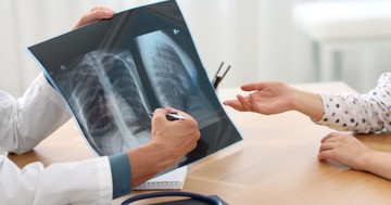 Milyen gyakran lehet röntgenezni? Ez a modern orvostudomány válasza egy régi félelemre