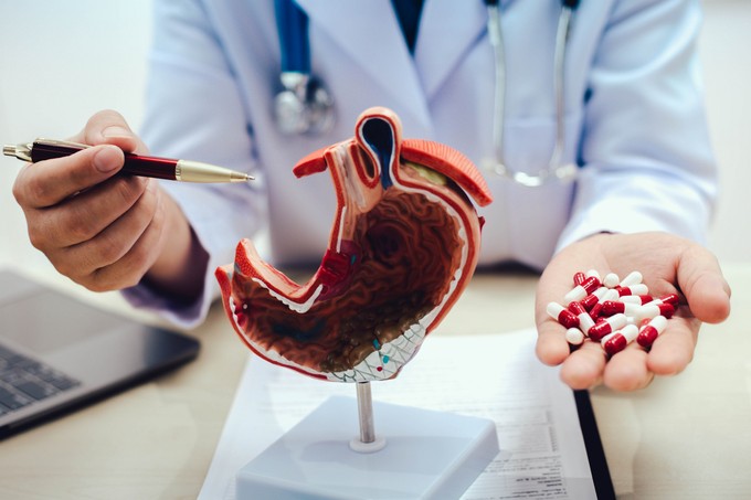 Sok a sava, refluxbeteg? Nem mindegy milyen fájdalomcsillapítót vesz be, ha fáj valamije című cikk nyitóképe