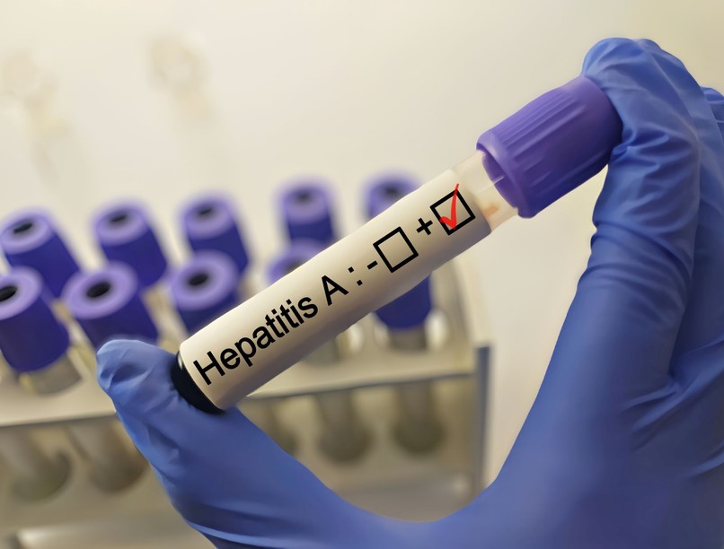 hepatitis A vírus NNGYK terjed hírek