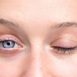 Mire utal a gyakori pislogás? című cikk nyitóképe