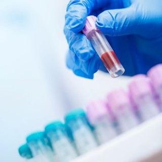 Ez a teszt sokkal többet árul el a szívéről, mint a „rossz” koleszterin szintje című cikk nyitóképe