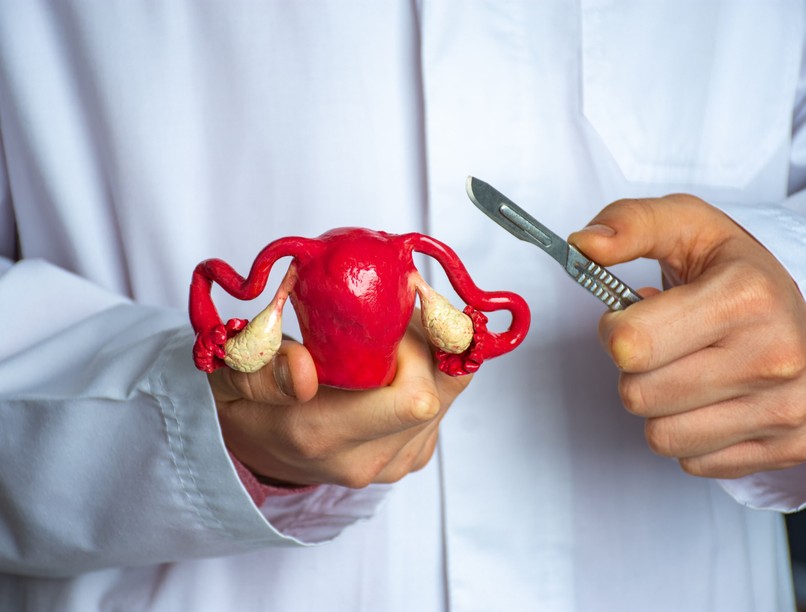 mióma ellen műtét zsugorítás