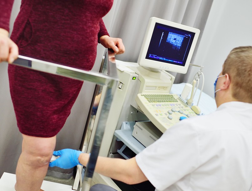 vérrög, trombózis, ultrahang, koronavírus, vérrögképződés, D-dimer szint, trombózis, oltás, vakcina, koronavírus, tünetei