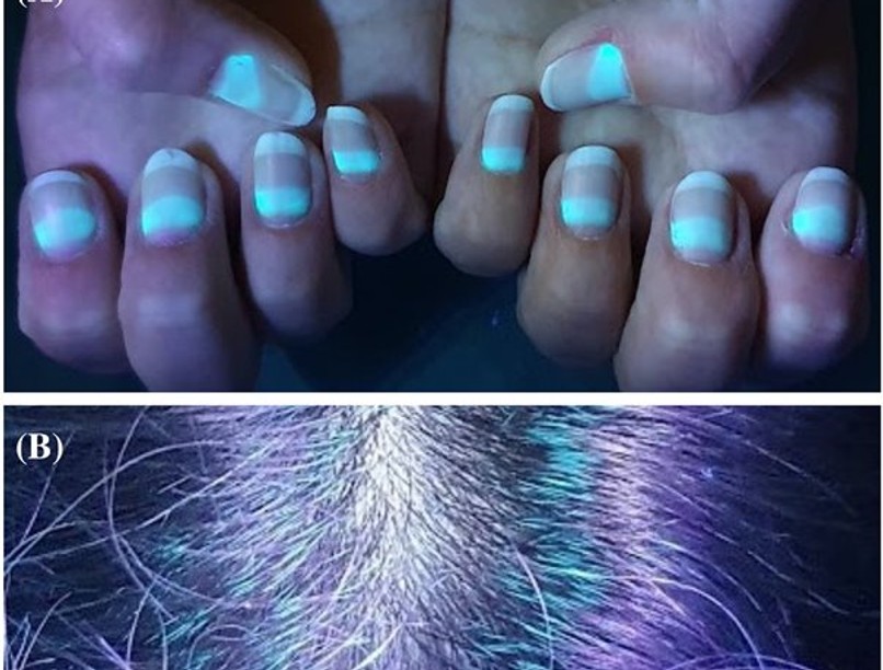 favipiravir mellékhatása, koronavírus, fluoreszkálás