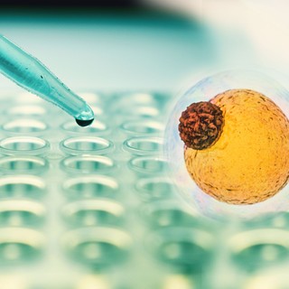 Zsírkapcsoló: megvan hogyan zabolázható meg a hízás! Tudósok azonosítottak egy epigenetikai kapcsolót, amely blokkolja a zsírsejtek kialakulását című cikk nyitóképe