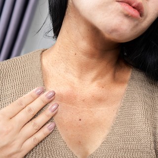 Gyanús foltok, göbök, elszíneződések a bőrön: ekkor jelez pajzsmirigyzavart című cikk nyitóképe