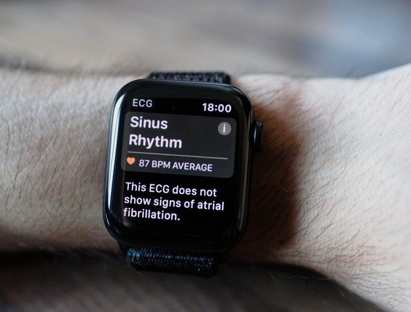 értékelhető EKG okosóra megbízható orvos válaszol