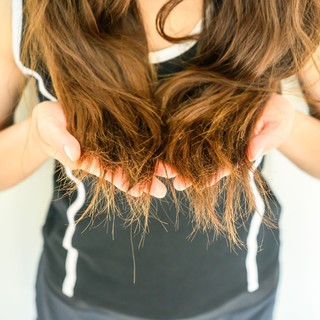 Nem a sampon a hibás! Kiderült, miért nem nő a haja – a megoldás a konyhájában van című cikk nyitóképe